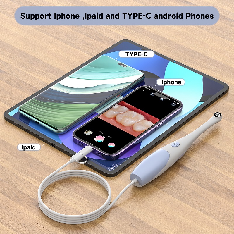 TYPE-C Visuele Mondcamera voor - Endoscope Inspection Camera recensie en prijs