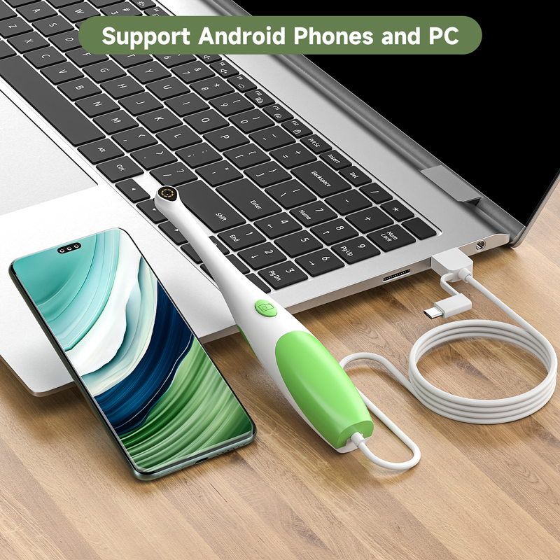 3-in-1 Android Endoscoop Mondc - Endoscope Inspection Camera recensie en prijs