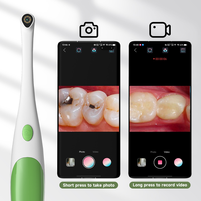 3-in-1 Android Endoscoop Mondc - Endoscope Inspection Camera recensie en prijs